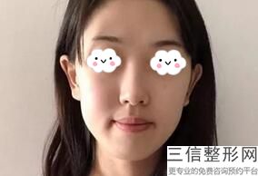 山东隆鼻医院排名榜前五口碑实力推荐,隆鼻医院哪个好