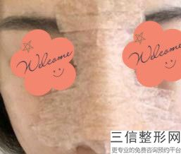 山西隆鼻医院排名榜前五强公立私立上榜,山西整容医院哪家好