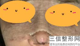陕西省隆鼻医院排名前五发布,西安良好的隆鼻医院叫什么