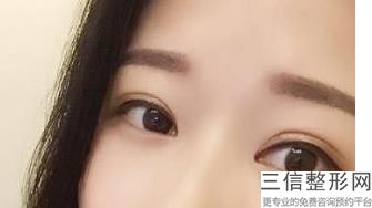 陕西西安眼科整形医院排名榜前五口碑推荐,西安眼部整形医生排名