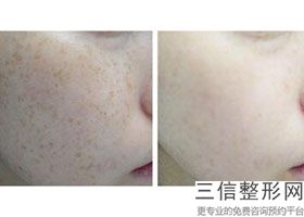 汕头热玛吉官方授权医院排名表,海南热玛吉认证医院