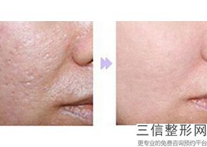 汕头热玛吉官方授权医院排名表,海南热玛吉认证医院