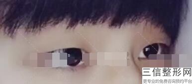 上海10大双眼皮医生排行榜,上海双眼皮比较厉害的医生