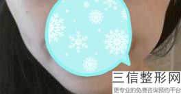 上海M唇做的好的医院排行榜前六汇总,上海做m唇哪家医院好