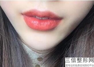 上海M唇做的好的医院排行榜前六汇总,上海做m唇哪家医院好