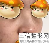 上海鼻头肥大整形医院排名榜六强点评,上海鼻部整形良好医院