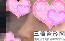 上海鼻整形医生排名四大权威专家盘点,上海有名的鼻整形医生