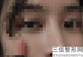 上海鼻整形医生排名四大权威专家盘点,上海有名的鼻整形医生