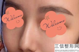上海鼻整形医生排名四大权威专家盘点,上海有名的鼻整形医生