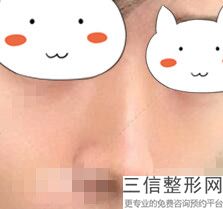 上海鼻整形医生排名四大权威专家盘点,上海有名的鼻整形医生