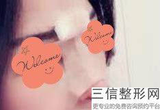 上海鼻整形医生排名四大权威专家盘点,上海有名的鼻整形医生