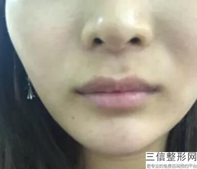 上海唇部公立整形医院排行榜前十,上海唇部整形有名的医生