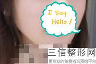 上海唇部整形三甲医院排名前十尽显,中国良好的唇部整形医院