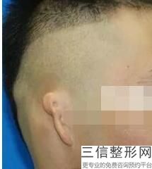 上海耳部整形医院排行榜四大知名机构揭晓,中国耳部整形良好的医院