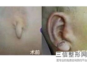 上海耳部整形医院排名榜六强权威评点,中国耳部整形良好的医院