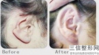 上海耳部整形医院排名榜六强权威评点,中国耳部整形良好的医院