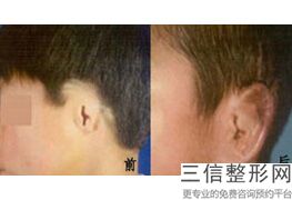 上海耳朵整形医院排名榜六强权威盘点,耳朵整形公立医院排名