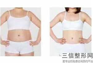 上海丰胸整形医院排行前十阵容列表请围观,上海哪家医院丰胸做的好