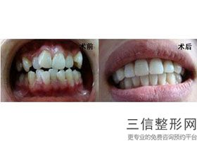 上海公立口腔医院排名榜top5权威揭晓,上海公立医院口腔科排名