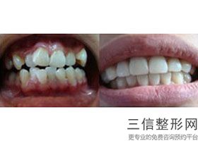 上海较好的牙科医院排名榜前十名单发布,上海比较好的牙科医院排名