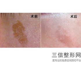 上海九院拉皮除皱医生排行榜top7名单发布,上海第九人民医院拉皮医生