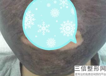 上海九院拉皮除皱医生排行榜top7名单发布,上海第九人民医院拉皮医生