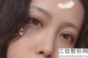 上海九院双眼皮专家排名榜被苏薇洁,上海九院双眼皮医生