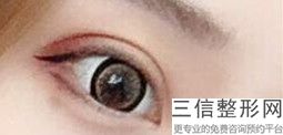 上海九院双眼皮专家排名榜被苏薇洁,上海九院双眼皮医生