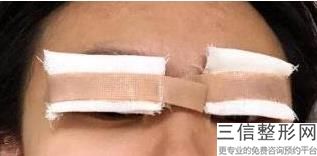 上海九院眼科整形专家排名前三评选出炉,上海九院眼睛整形专家排行榜
