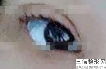 上海九院眼科整形专家排名前三评选出炉,上海九院眼睛整形专家排行榜