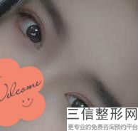 上海九院眼科整形专家排名前三评选出炉,上海九院眼睛整形专家排行榜