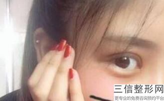 上海九院眼科整形专家排名前三评选出炉,上海九院眼睛整形专家排行榜