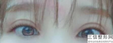 上海九院眼科整形专家排名前三评选出炉,上海九院眼睛整形专家排行榜