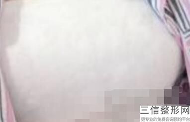 上海九院整形科隆胸专家介绍,上海九院隆胸医生