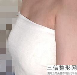 上海九院整形科隆胸专家介绍,上海九院隆胸医生