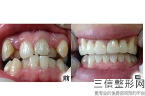 上海口腔科医院排名前十发布,上海口腔科排名前十的大医院