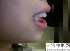 上海口腔医院牙齿矫正排名榜前六名单出炉,上海牙齿矫正正规医院排名