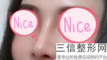 上海隆鼻好的医院排名榜前四出炉啦,上海隆鼻整形医院排名