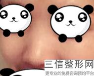 上海隆鼻好的医院排名榜前四出炉啦,上海隆鼻整形医院排名