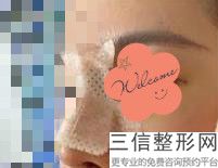 上海隆鼻好的医院排名榜前四出炉啦,上海隆鼻整形医院排名