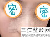 上海隆鼻好的整形医院排名榜前四强公布,上海鼻部整形医院排名前三的