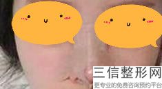 上海隆鼻较好的整形医院排名榜前五公示,上海隆鼻那家整形医院好