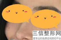 上海隆鼻医生排名前十权威盘点,上海隆鼻比较好的医生