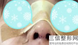上海隆鼻整形美容医院排行榜前十,上海鼻子整形医院排名前十