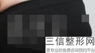 上海隆胸排名前十整形医院名单公示,上海隆胸专家排行榜