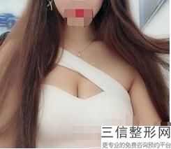上海隆胸整形医院排名榜top5在此,上海隆胸哪个医院比较好