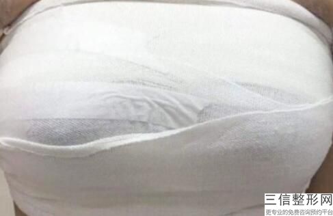 上海隆胸整形医院排名前十入选名单发布,上海隆胸哪个医院比较好
