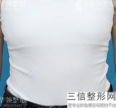 上海隆胸整形医院排名前十入选名单发布,上海隆胸哪个医院比较好