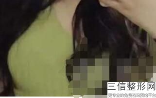 上海隆胸整形医院排名前十入选名单发布,上海隆胸哪个医院比较好