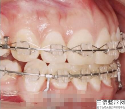 上海哪个口腔医院比较好,上海哪里口腔医院好